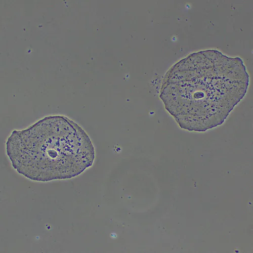 figura dispositivo a contrasto di fase MAGUS PH2,  15