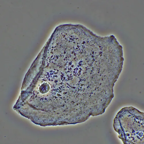 figura dispositivo a contrasto di fase MAGUS PH2,  16