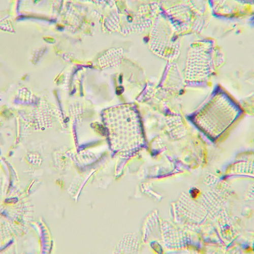 fotografia microscopio biologico digitale MAGUS Bio D290T LCD,  32