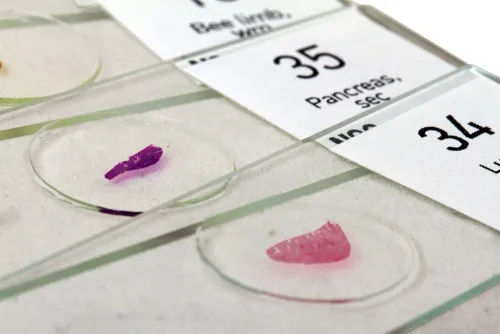 foto set di vetrini "See it all!" (Alla scoperta del mondo!) Levenhuk N80 NG,  6