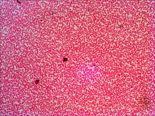 immagine set di vetrini preparati Levenhuk N38 NG,  16