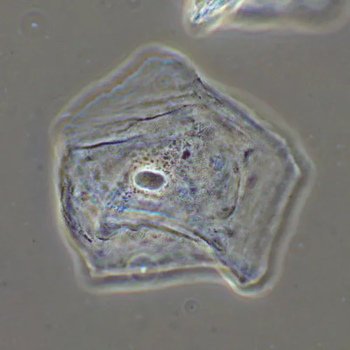 foto dispositivo a contrasto di fase MAGUS SPH2,  16