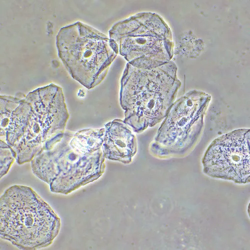 foto dispositivo a contrasto di fase MAGUS SPH2,  15
