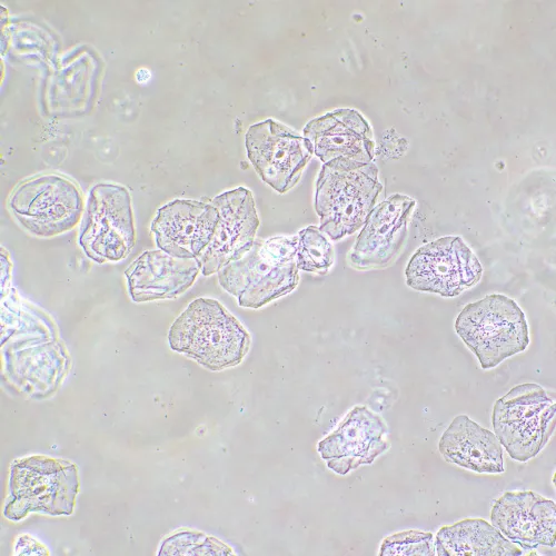 foto dispositivo a contrasto di fase MAGUS SPH2,  14