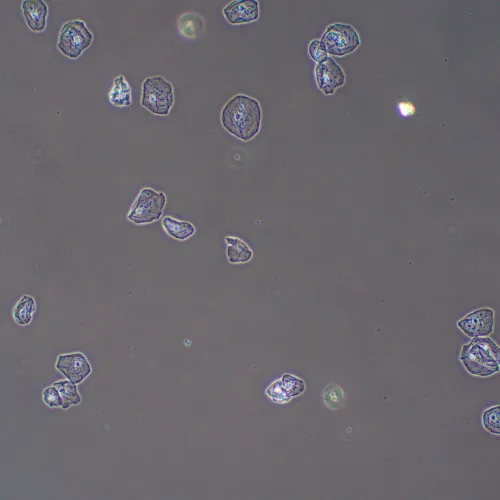 figura dispositivo a contrasto di fase MAGUS PH2,  13